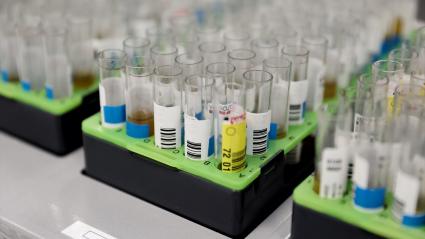 Probetas de pruebas PCR en el Laboratorio de Microbiología del Hospital público Gregorio Marañón