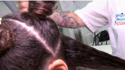 Los piojos proliferan en otoño