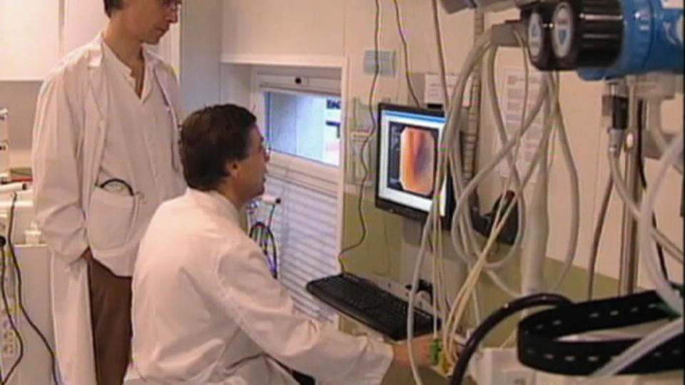 cancer colon