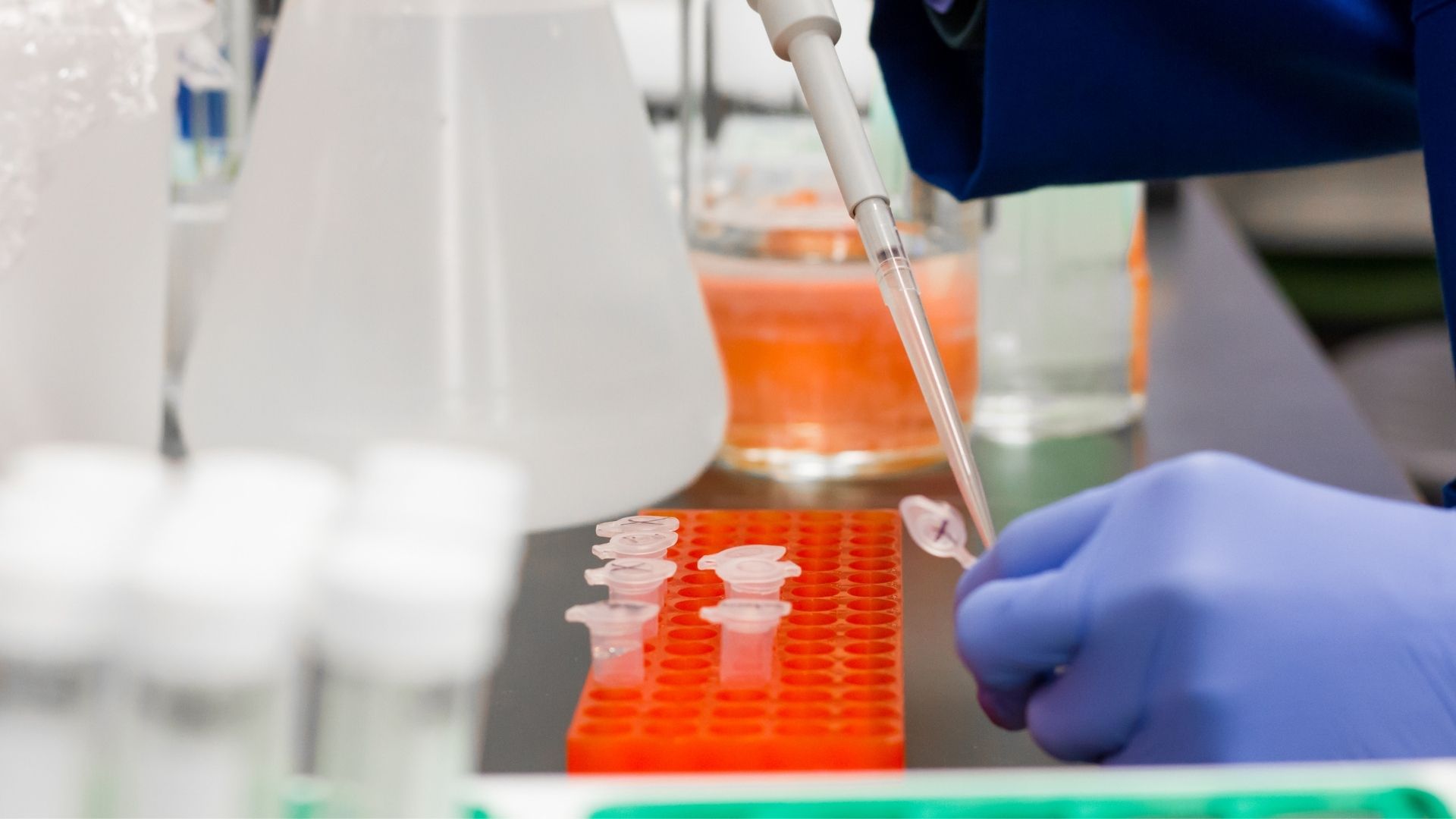 Prueba PCR en una imagen de archivo