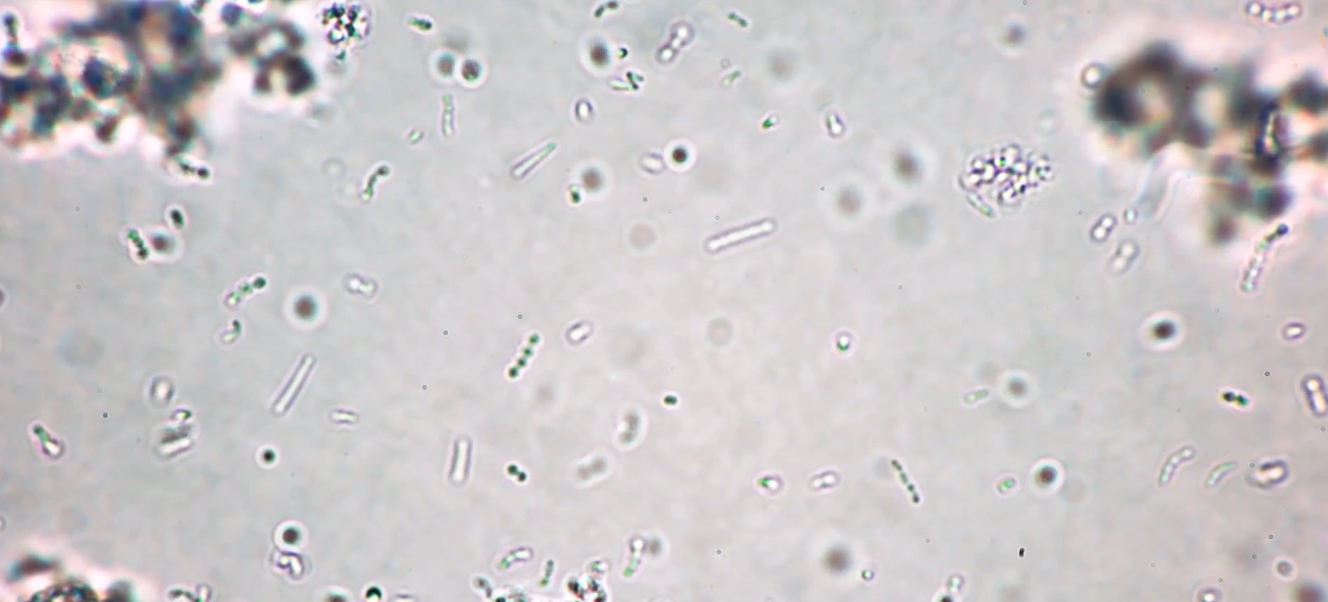 Meningitis