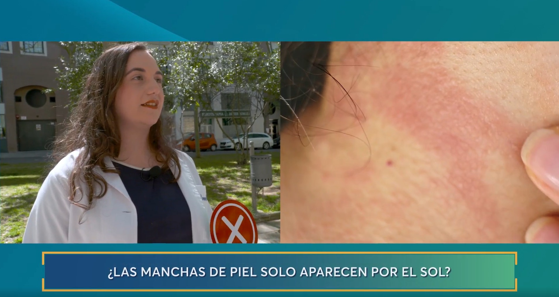 Mitos y verdades sobre la piel