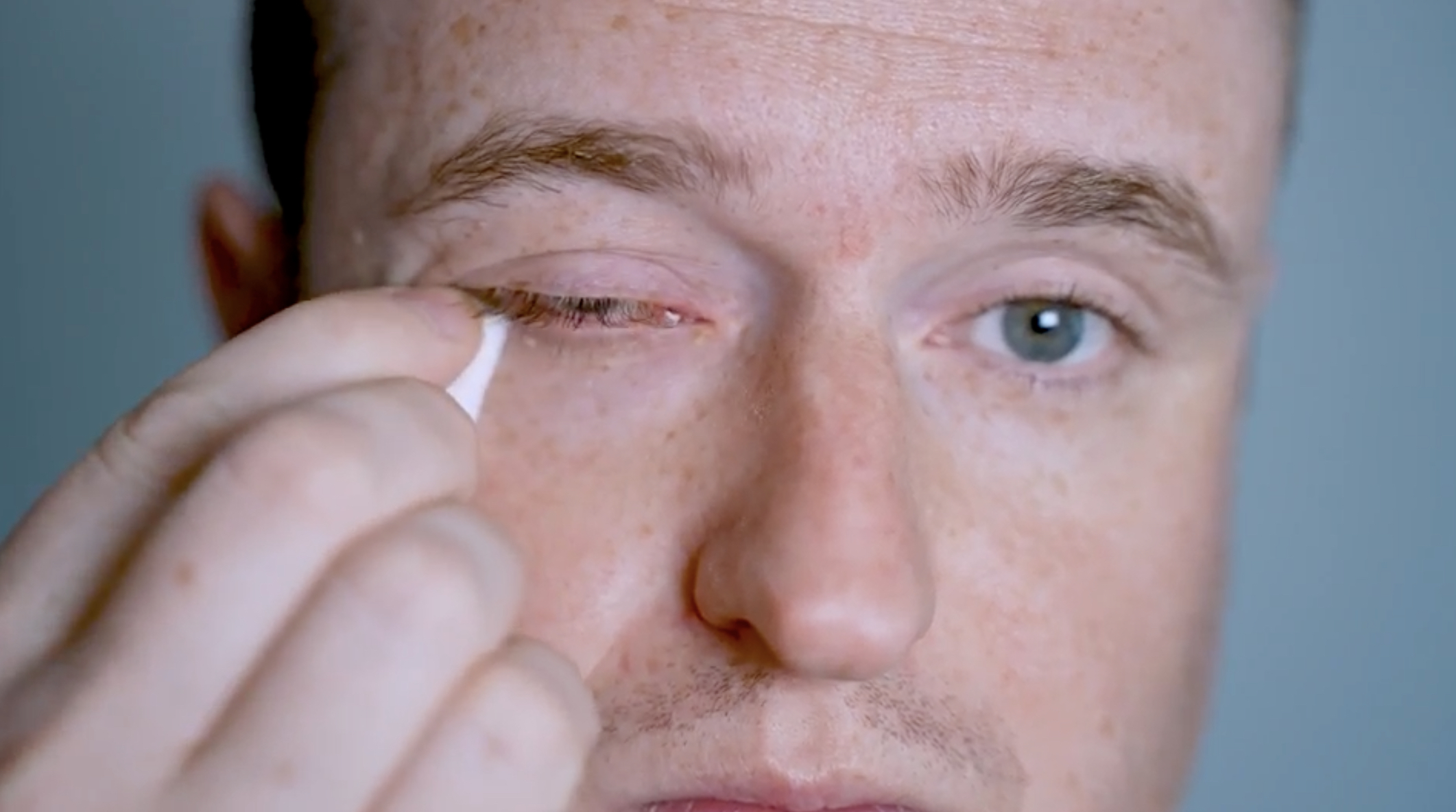 Higiene ocular