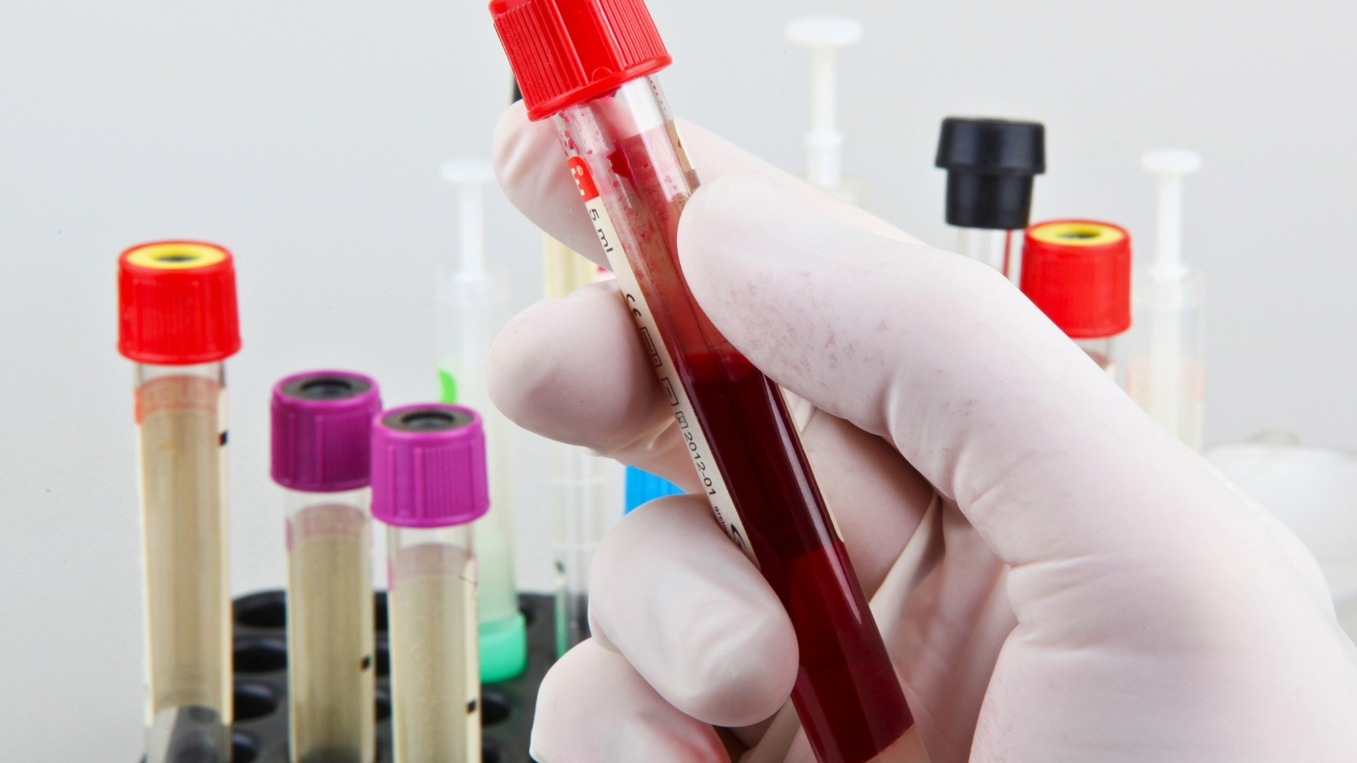 Analíticas de sangre