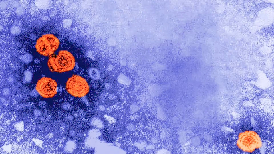 HEPATITIS