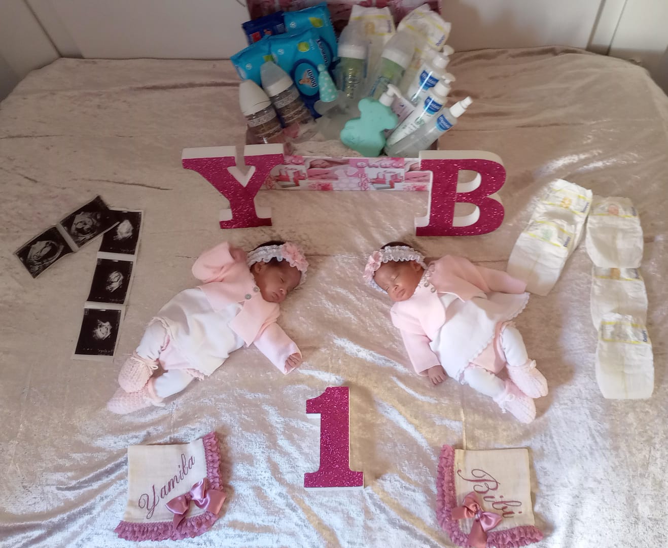 Bibi y Yamila, pocas semanas después de nacer prematuramente
