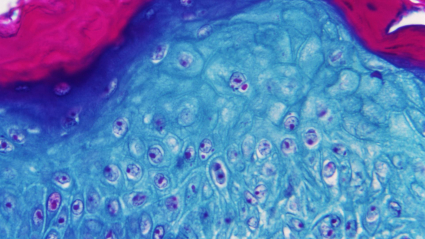 Imagen ampliada con un microscopio de una muestra de piel de un mono infectado con el virus de la viruela del mono. Nueve comunidades han detectado ya posibles casos sospechosos de viruela del mono, de la que ya hay 20 casos confirmados por el Ministerio de Sanidad y otros 16 están pendientes de resultados definitivos de secuenciación.