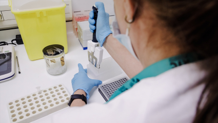 Una técnico de laboratorio prepara una PCR para el análisis de la viruela del mono
