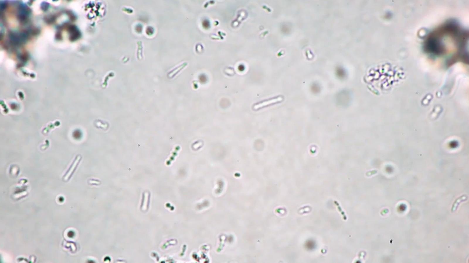 Meningitis