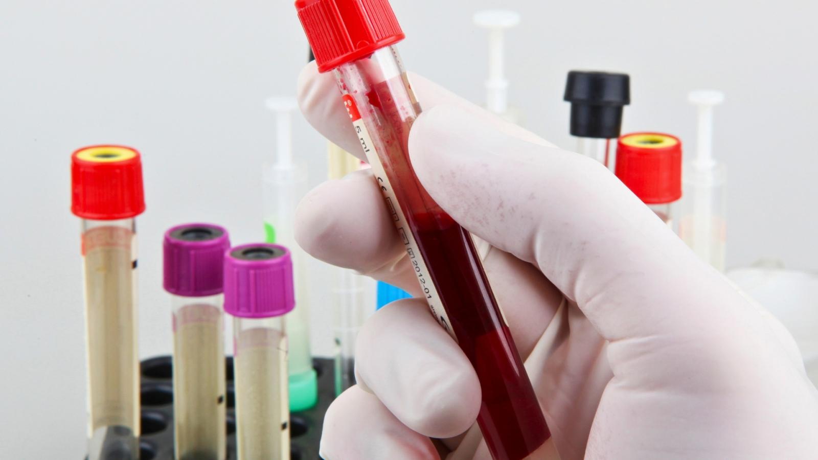 Analíticas de sangre