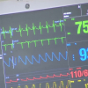 Monitor cardíaco de una UCI