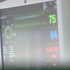 monitor de uci