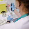Una técnico de laboratorio prepara una PCR para el análisis de la viruela del mono