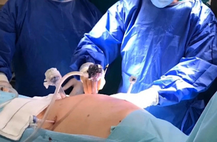 Operación en el Servicio Extremeño de Salud