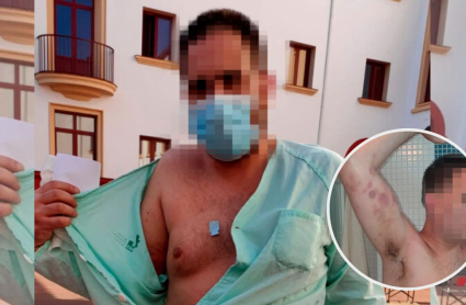 Imagen del hombre presuntamente agredido por la Policía Local